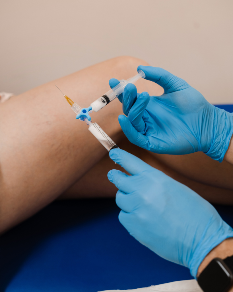 escleroterapia com espuma